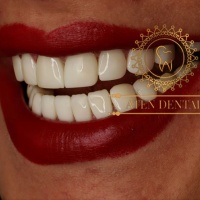 JustPasteIt profile picture for @dental