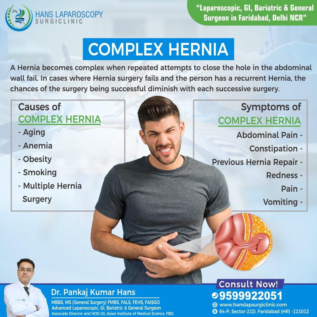 Get Hernia Specialist in Faridabad - JustPaste.it