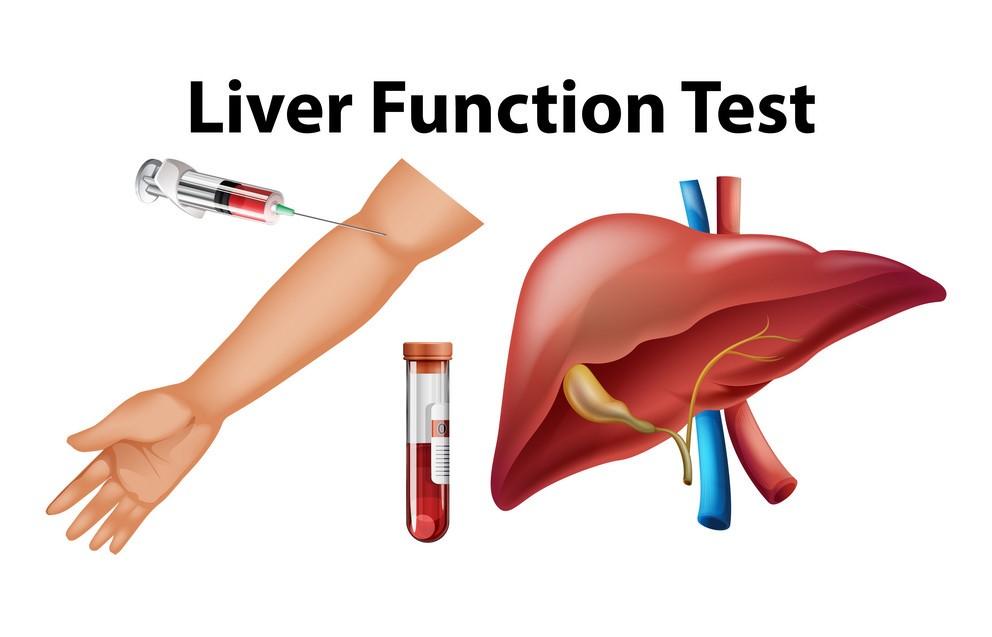 Everything You Need To Know About The Liver Function Test LFT 