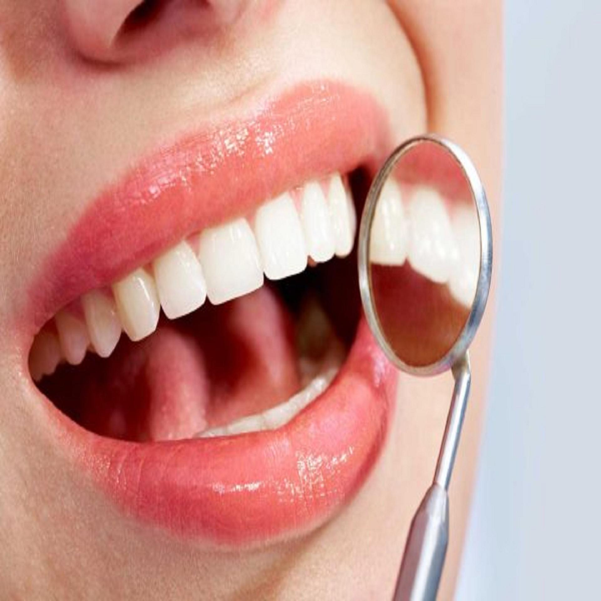 What are the different methods for teeth whitening What are the different methods for teeth whitening