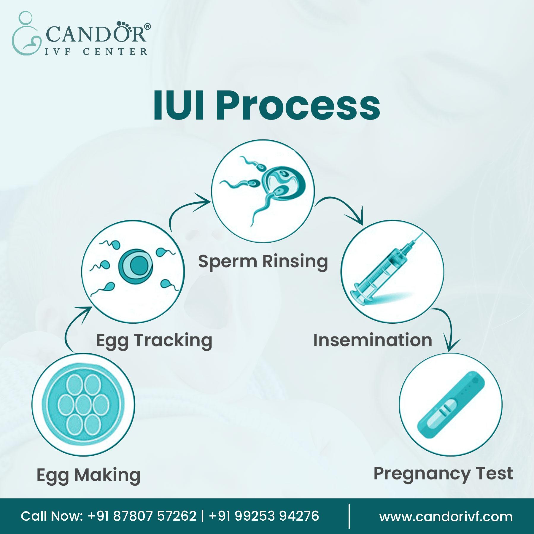 IUI Treatment Process - JustPaste.it