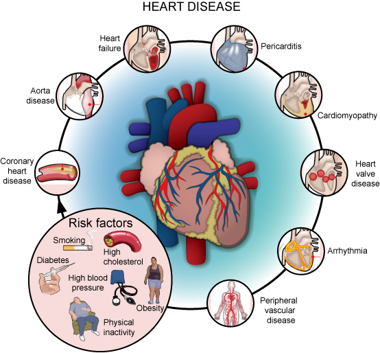 Heart Disease Its Types