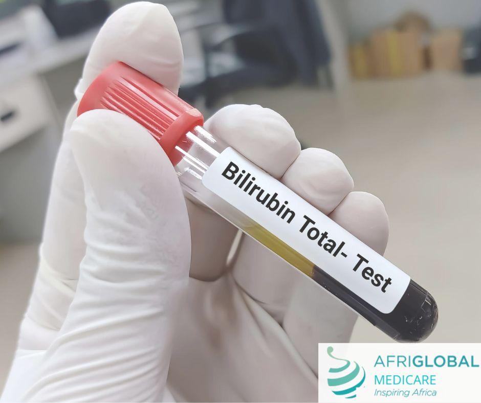 Bilirubin Test Justpasteit 5068