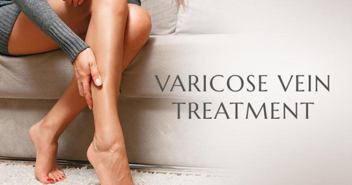 vericoseveintreatment720x380.jpg