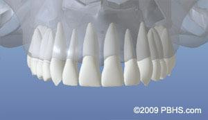 dentalimplant_01.jpg