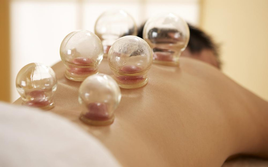 cuppingtherapy.jpg