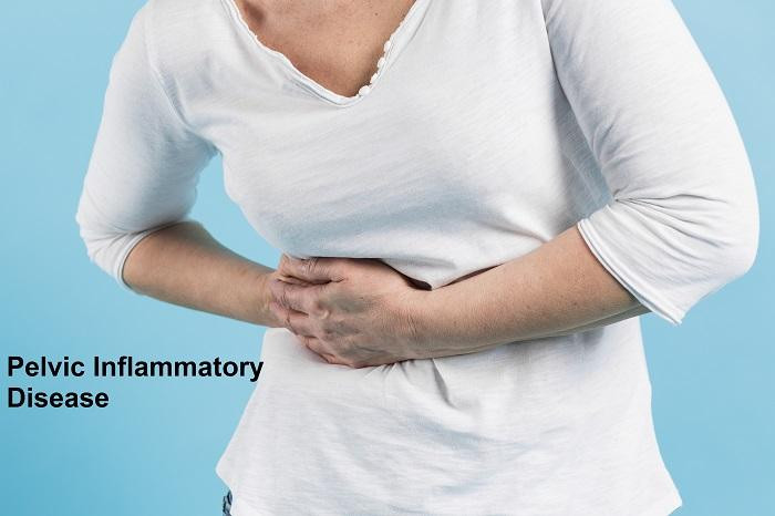 What Pelvic Inflammatory Disease Feels Like? And Is This PID Is Serious ...