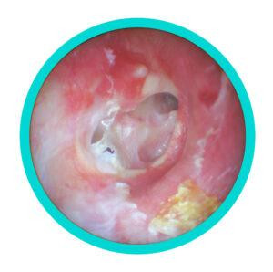 earinfections1300x298.jpg