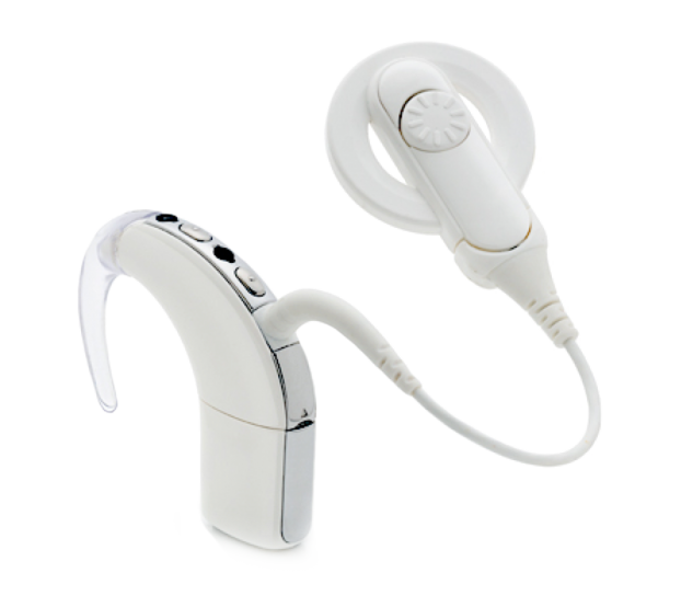 cochlear_implant622x554.png