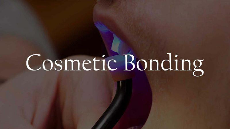 cosmeticbondingservice800x450.jpg