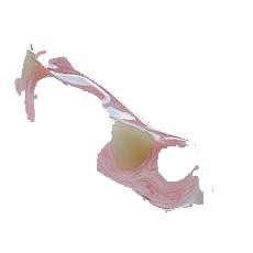 flexiblepartialdenture.jpg flexiblepartialdenture.jpg