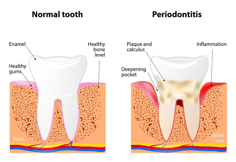 lanapsurgerythedentistryofthefutureisrightinsunnyisles.jpg