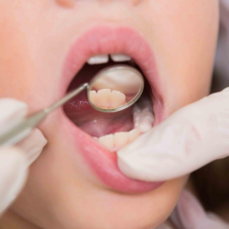 dentisttomballtexaschildrensdentistryscaled.jpg