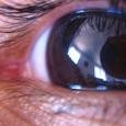 glaucoma115x115.jpg