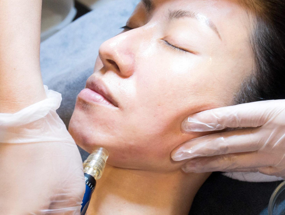 beautymicroneedling4.jpg