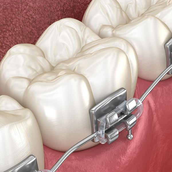 orthodontic1_grande1.jpg