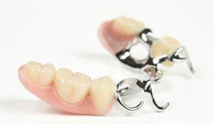 partialdentures300x175.jpg partialdentures300x175.jpg