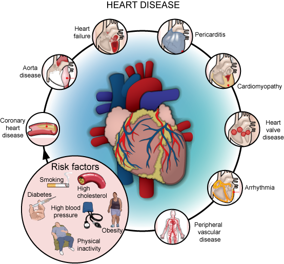 types of heart disease.png