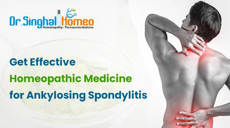 Ankylosing Spondylitis Treatment in Homeopathy - Early Intervention, Prevent Bone Fusion